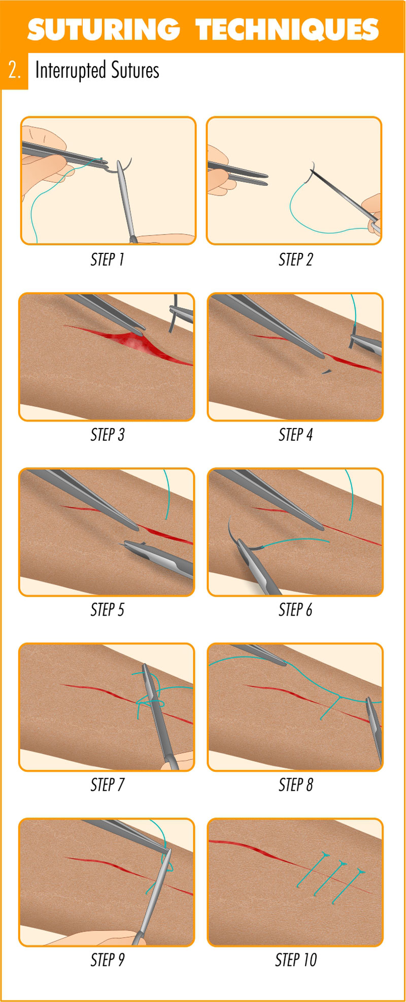 Purse-string skin closure scar three months post | Download Scientific  Diagram